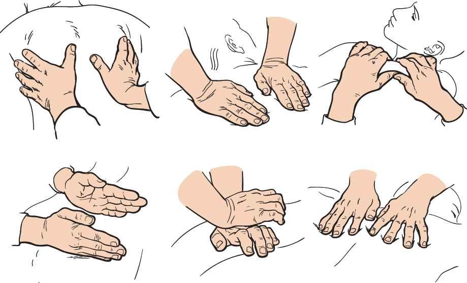 Types of Sports Massage
