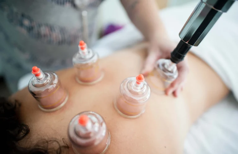 Cupping Therapy FAQ – Is It Safe Lotus Massage Bahrain