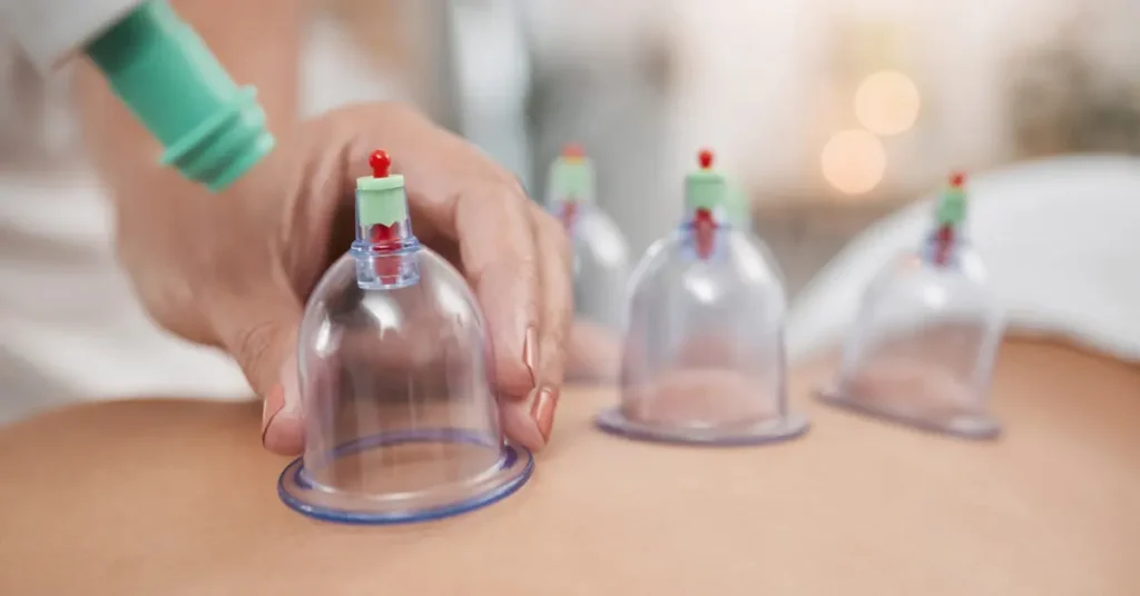 Cupping Therapy Price in Bahrain (BHD) 2026