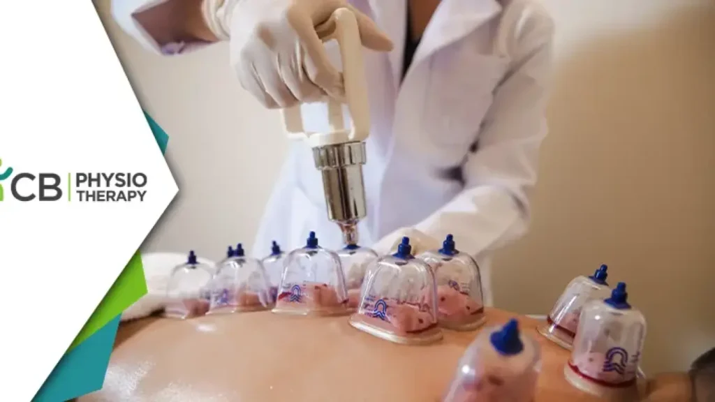 Why People in Bahrain Seek Cupping Therapy